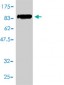 SOCS6 Antibody (monoclonal) (M01)